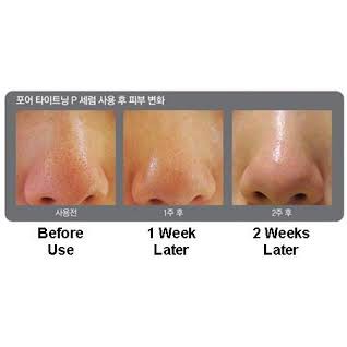 Serum se khít Lỗ chân lông BRTC BRTC Pore Tightening Serum 60ml | BigBuy360 - bigbuy360.vn