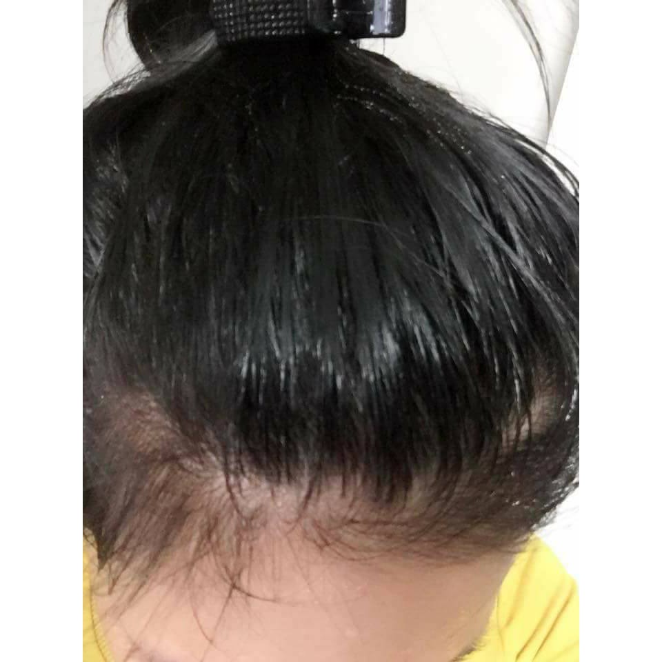 LOTION BƯỞI | BigBuy360 - bigbuy360.vn