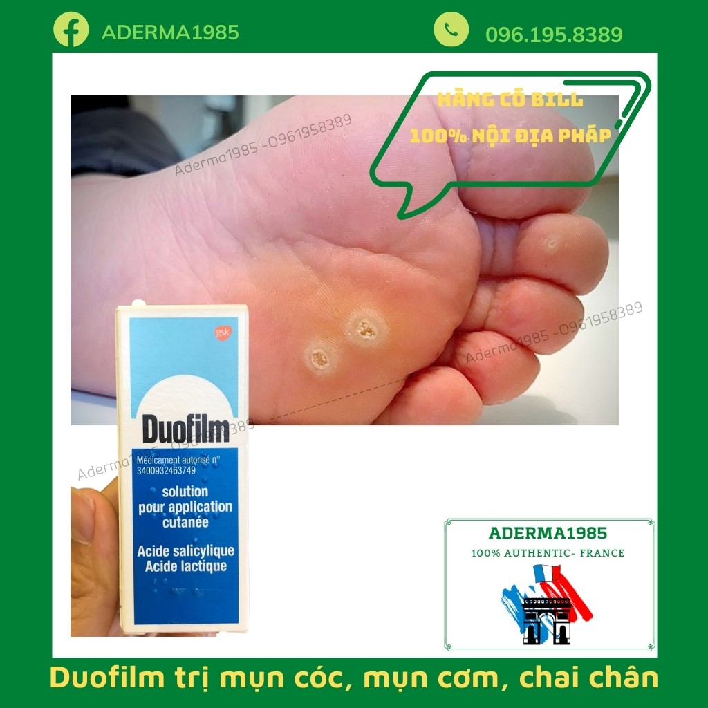 Dung dịch Duofilm 15ml dưỡng, làm sạch mụn cơm, mụn cóc, chai chân lâu ngày (Hàng pháp)