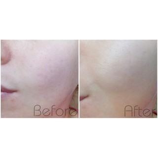 Kem Nền Revlon Colorstay 24h