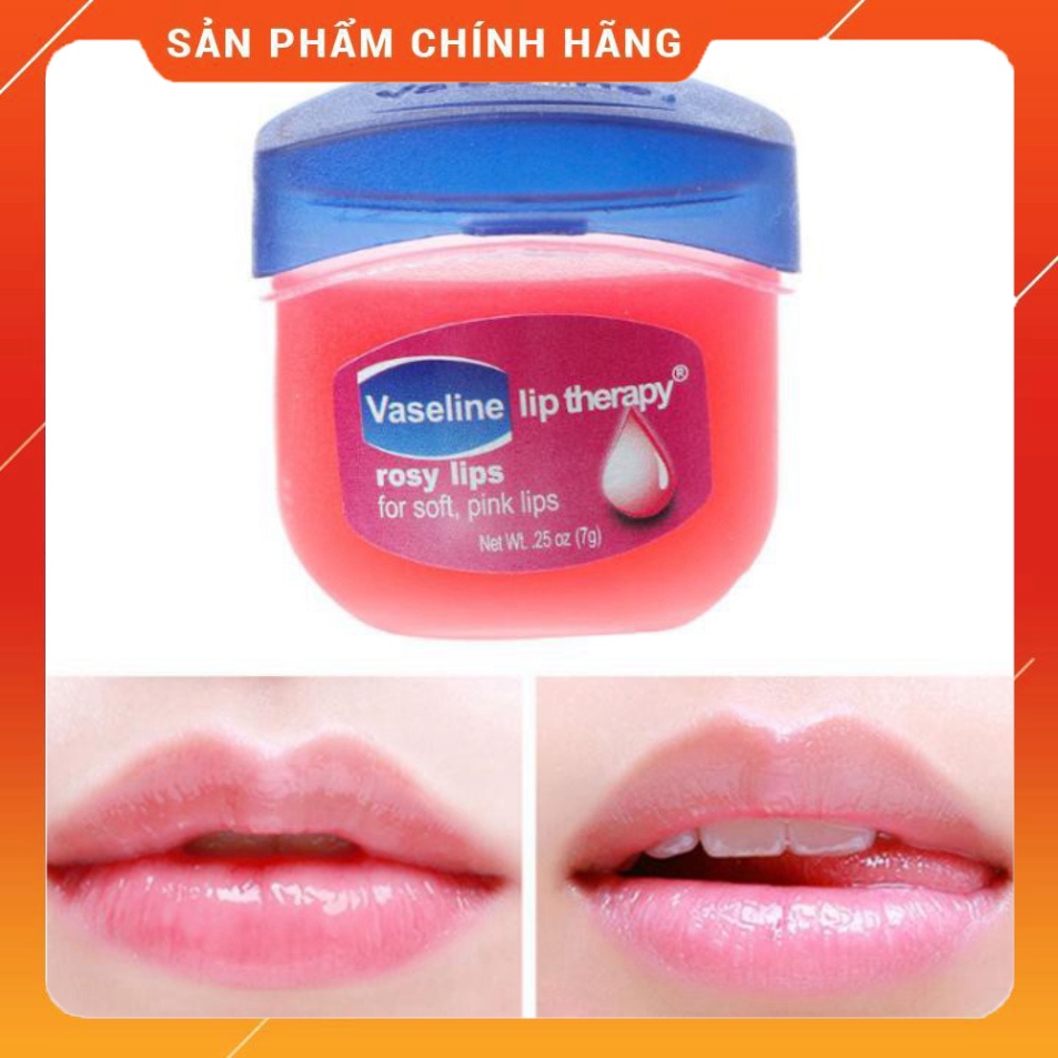 SON DƯỠNG MÔI VASELINE LIP THERAPY HỒNG, XANH 7G