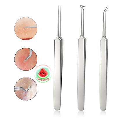 🍉Nhíp Gắp Mụn Trứng Cá Thép Không Gỉ DUASHOP