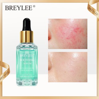 Tinh chất phục hồi đốm đỏ do kích ứng da nhạy cảm làm trắng BreyLee cao cấp
