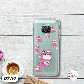 Ốp lưng dẻo cho Xiaomi Mi 10T Lite