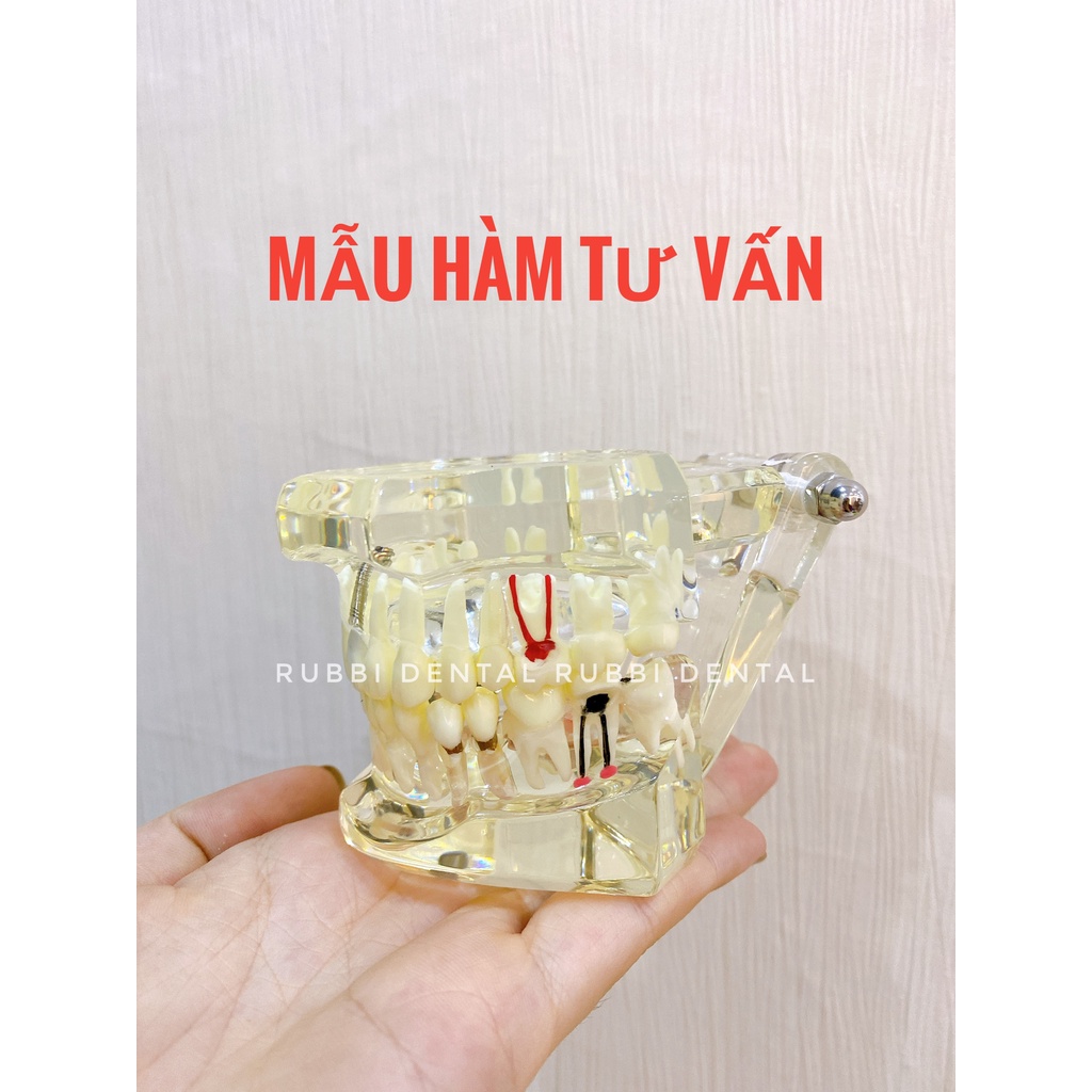 MẪU HÀM TƯ VẤN 8IN1 - ĐẦY ĐỦ CÁC BỆNH LÝ CẦN THIẾT TRONG NHA KHOA. PHÒNG KHÁM NÀO CŨNG CẦN CÓ. HÀNG CHUẨN