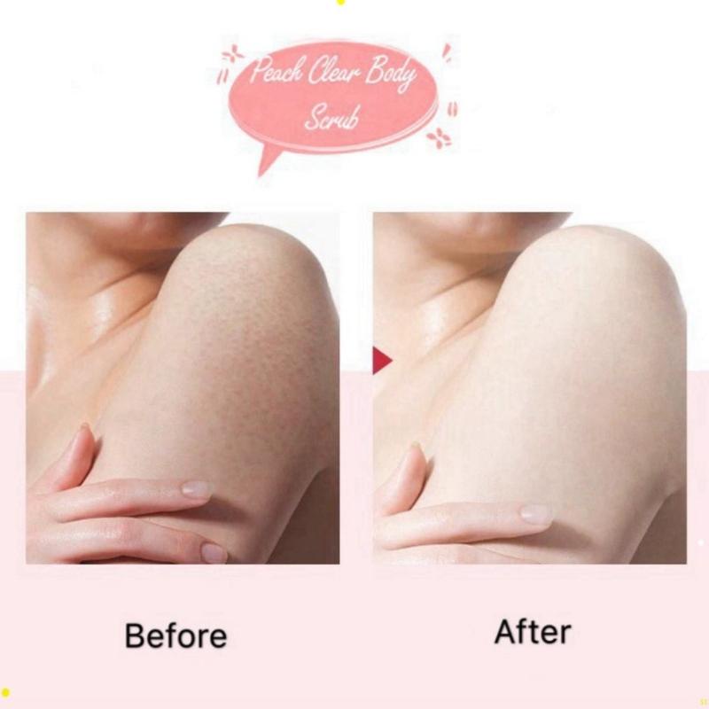 Tẩy tế bào chết da body đào Heyxi Peach Clear tẩy da chết body kem thải độc tố da TTB02