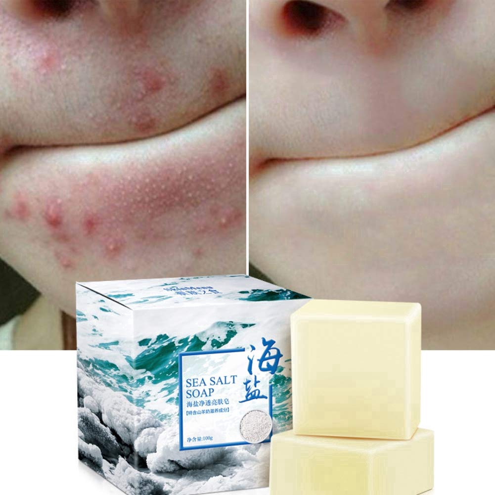 Xà Phòng Muối Biển Làm Trắng Thu Nhỏ Lỗ Chân Lông Loại Bỏ Mụn Đầu Đen Chăm Sóc Da