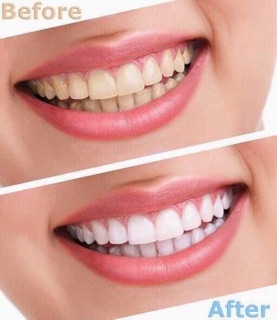 KEM ĐÁNH RĂNG HỒNG SÂM MUỐI BIỂN