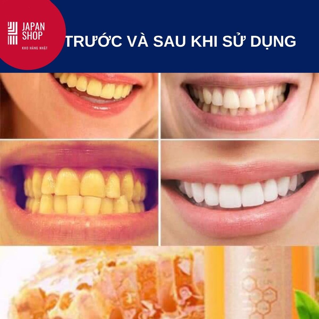 NƯỚC SÚC MIỆNG BONG MẢNG BÁM VÀ CAO RĂNG NHẬT BẢN PROPOLINES NHẬT BẢN