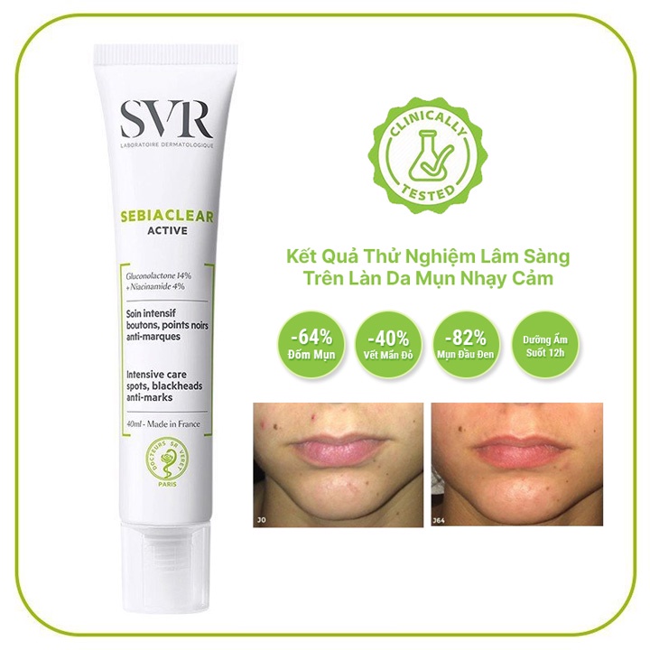 Kem Kiềm Dầu, Se Khít Lỗ Chân Lông, Giảm Thâm SVR Sebiaclear Mat + Pores 40ml Phù Hợp Cho Da Mụn