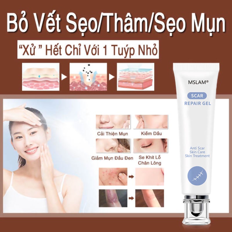 Kem che sẹo Giảm bỏng và bỏng nước Vết thương phẫu thuật v.v.mờ sẹo thâm mụn,mờ thâm ,khổi phục da,Kem chuyên xóa sẹo lồi lâu năm.