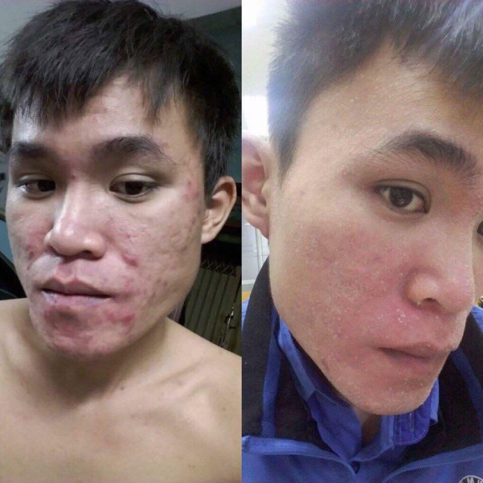 serrum thay da Nhân Sâm thảo dược đông y sạch mụn nám tái tạo da bong mạnh