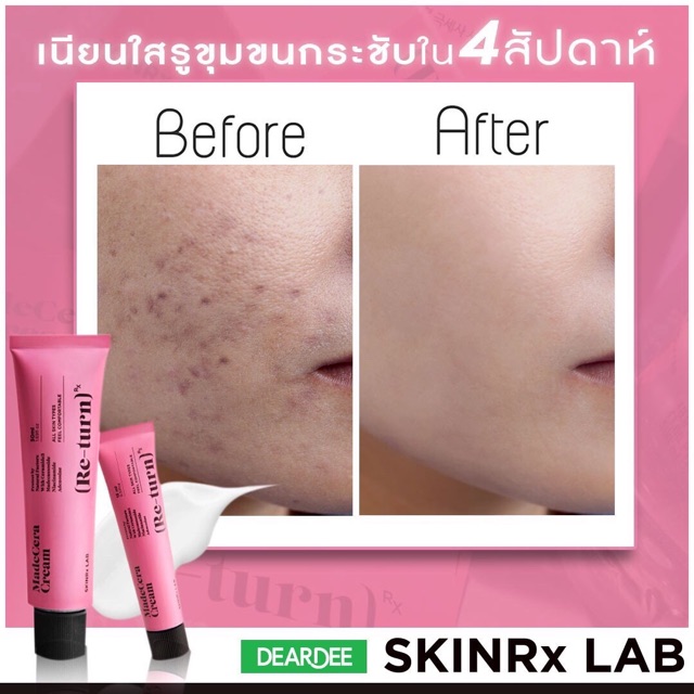 Kem hồi sinh da nám rổ mụn Madecera Return