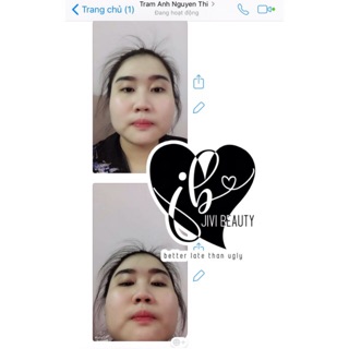 🍋 COMBO GỘI XỊT KÍCH MỌC GIẢM RỤNG ⭐️