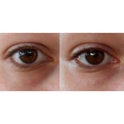 Dưỡng Mắt Chống Nhăn Drops Of Youth Eye Concentrate The Body Shop 10ML | BigBuy360 - bigbuy360.vn