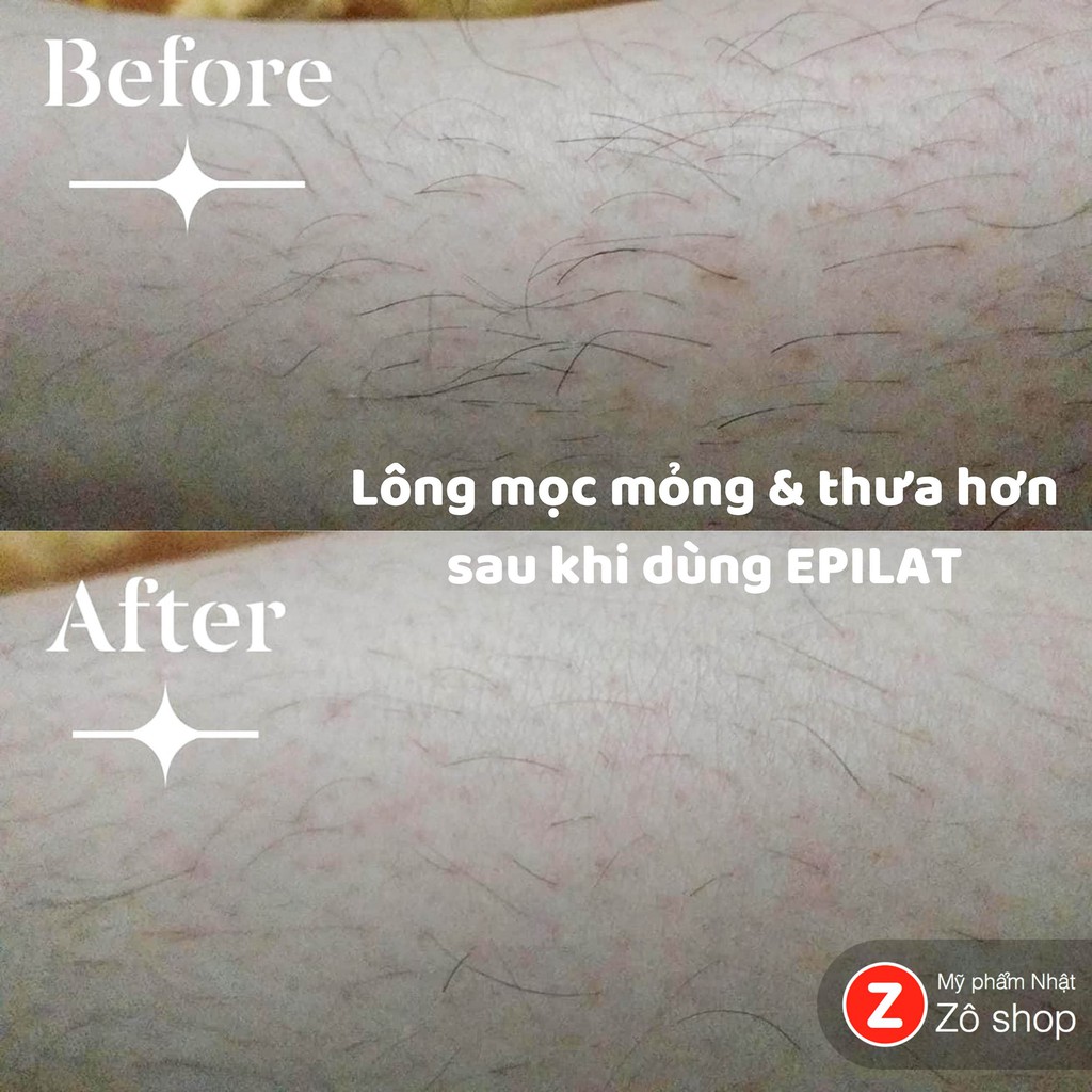 Kem tẩy lông cho da nhạy cảm - Kracie Epilat 150g | BigBuy360 - bigbuy360.vn