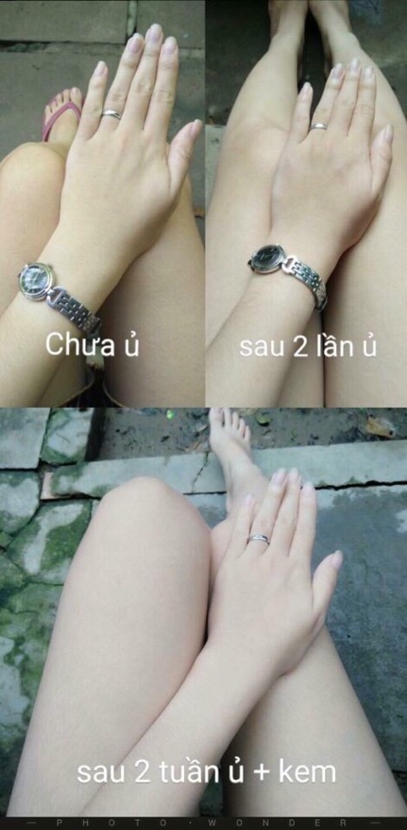 Men Ủ Body + 🎁 QUÀ tặng | BigBuy360 - bigbuy360.vn