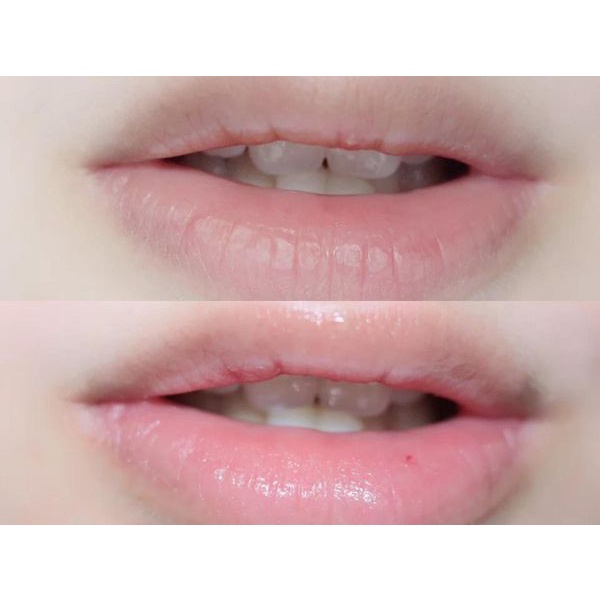 Sáp dưỡng ẩm Vaseline Blueseal 50ml / 100ml / 250ml