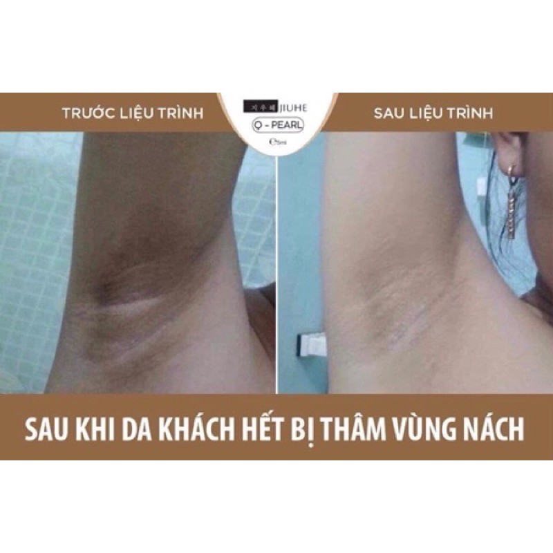 SERUM THÂM JUIHE MẪU MỚI