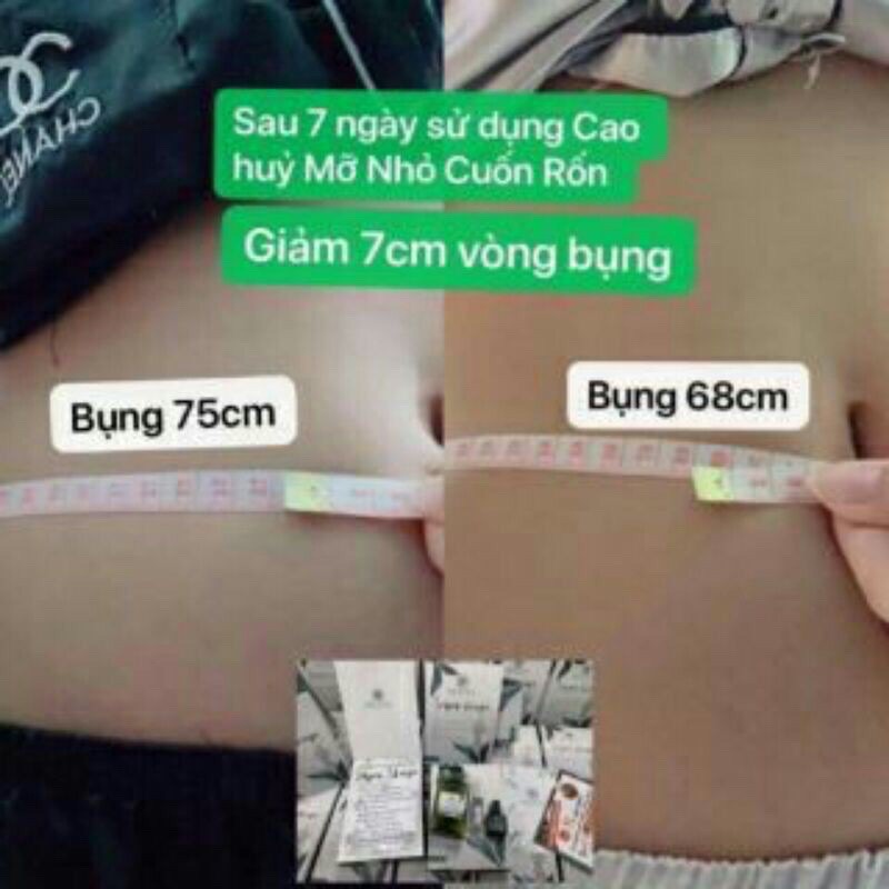 Cao huỷ mỡ nhỏ cuống rốn slim fix chính hãng tặng kèm đai bụng | BigBuy360 - bigbuy360.vn