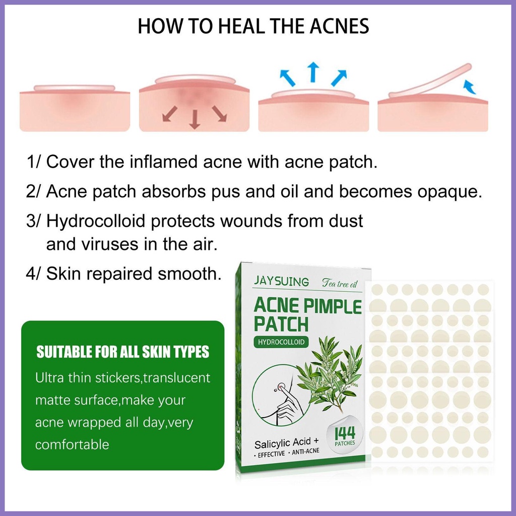 Miếng Dán Trị Mụn Vô Hình 144 Miếng nota2vn