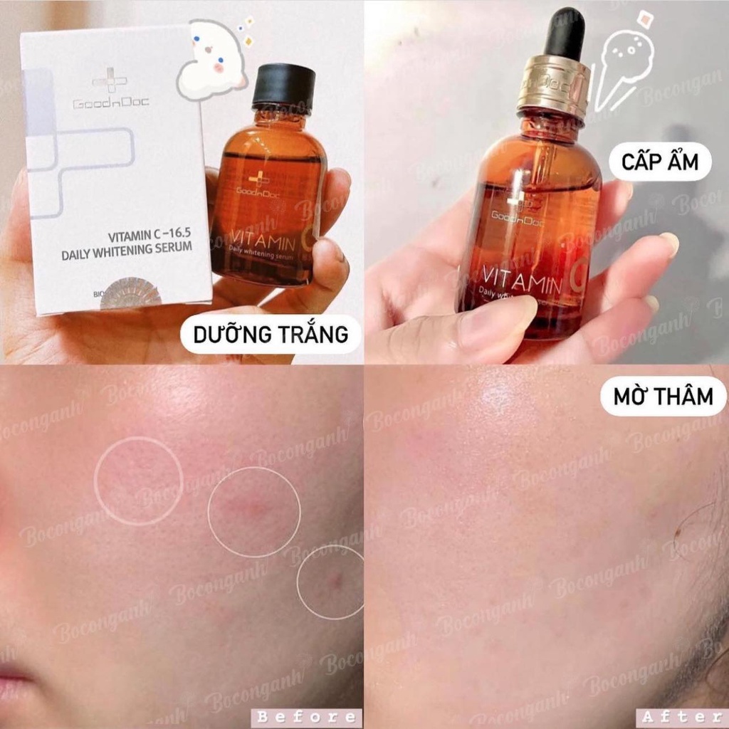 Serum Goodndoc Vitamin C Dưỡng Trắng Hàn Quốc 30ml