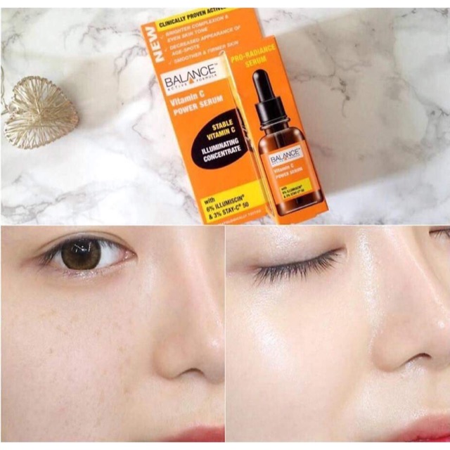 Serum Vitamin C