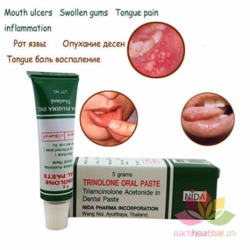 Kem Bôi Nhiệt Miệng Trinolone Oral Paste Thái Lan