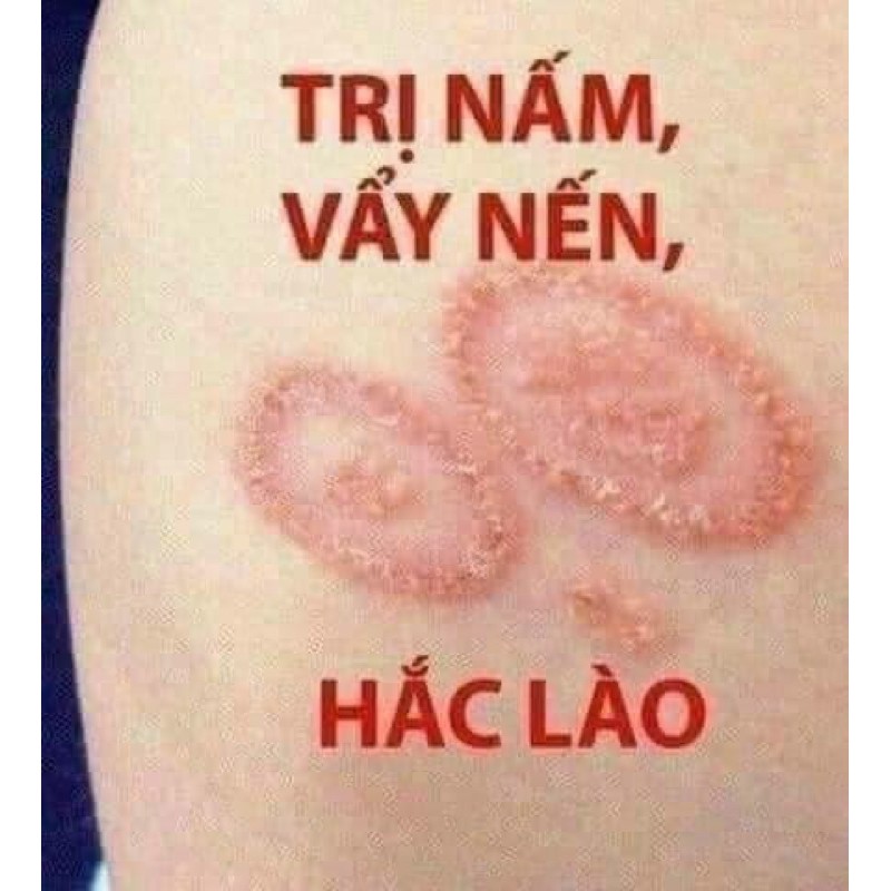Kem Bôi Ngoài Da Chống Nứt Nẻ Bong Tróc Khô Da Cực Hiệu Quả [ KEM BÔI NẺ VẨY NẾN ]