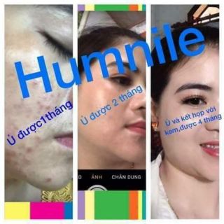 Ủ mặt  thảo dược  humnile (nhỏ)