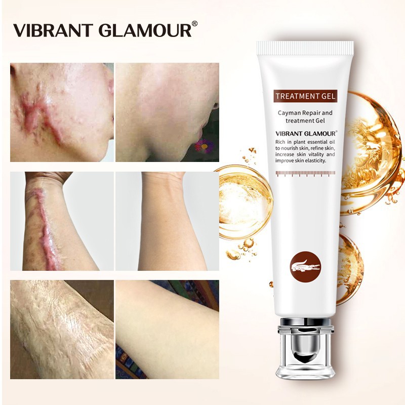 Gel VIBRANT GLAMOUR làm mờ sẹo vết rạn chai cải thiện các nốt mụn đầu đen dưỡng ẩm làm trắng da 20g | BigBuy360 - bigbuy360.vn
