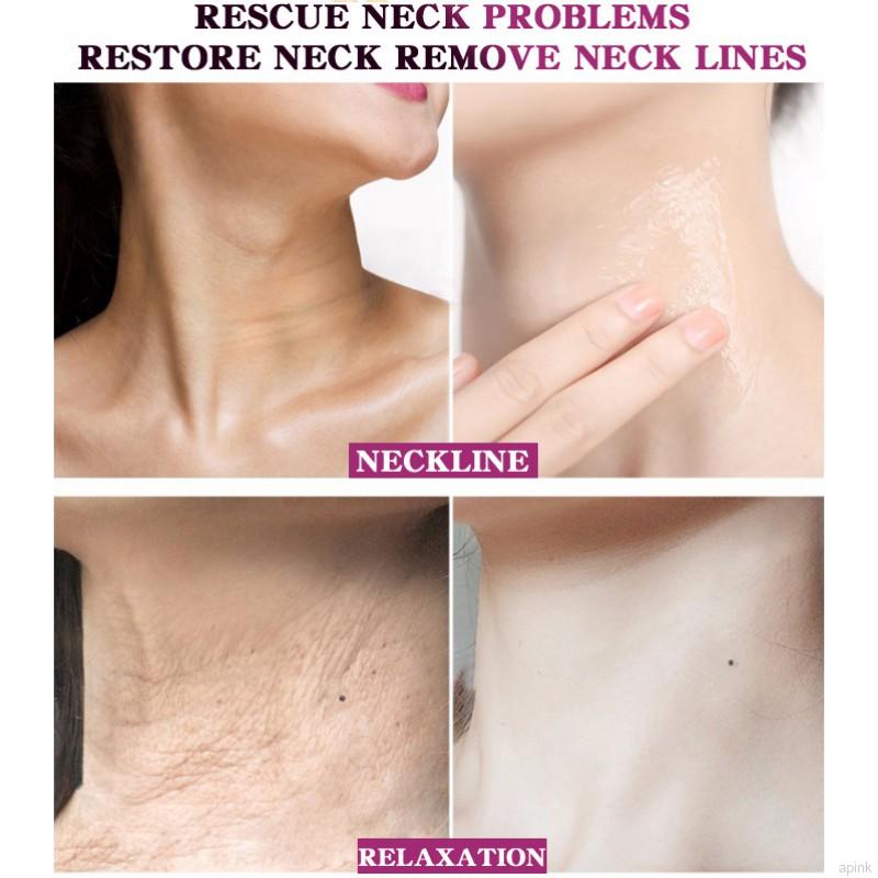 [Hàng mới về] Kem dưỡng ẩm làm trắng da xóa nếp nhăn trẻ hóa săn chắc vùng cổ 40g