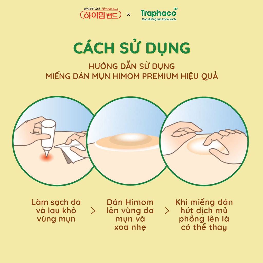 Miếng dán mụn HIMOM BAND- Hộp 36 miếng