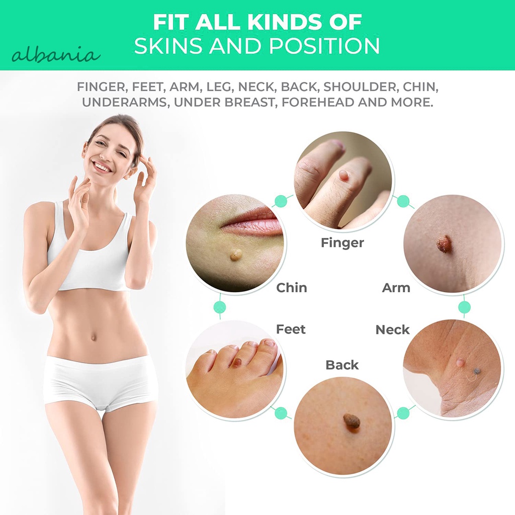 &lt; Albania &gt; Bộ Tăm Bông Tẩy Mụn Cóc Da Không Đau Dễ Sử Dụng Cho Toàn Thân