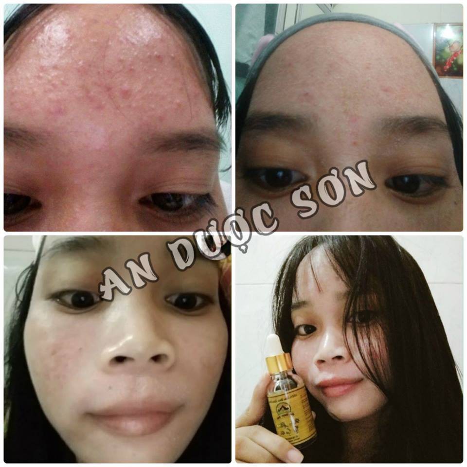 Combo An Dược Sơn Serum Và Bột Thảo Dược 50ml