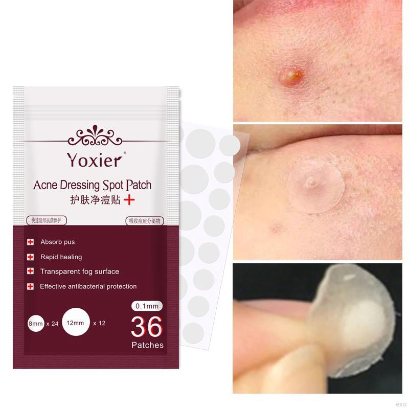 Face Patch Gel Patch Face Skin Care | BigBuy360 - bigbuy360.vn