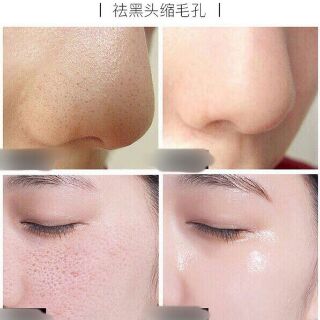 Tinh chất dưỡng shrinkage pore