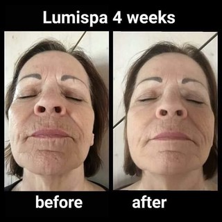 Đầu máy rửa mặt massage LUMISPA NUSKIN IO đầu máy Lumispa IO mẫu máy mới đầu máy silicon máy rửa mặt Lumispa IO Nuskin