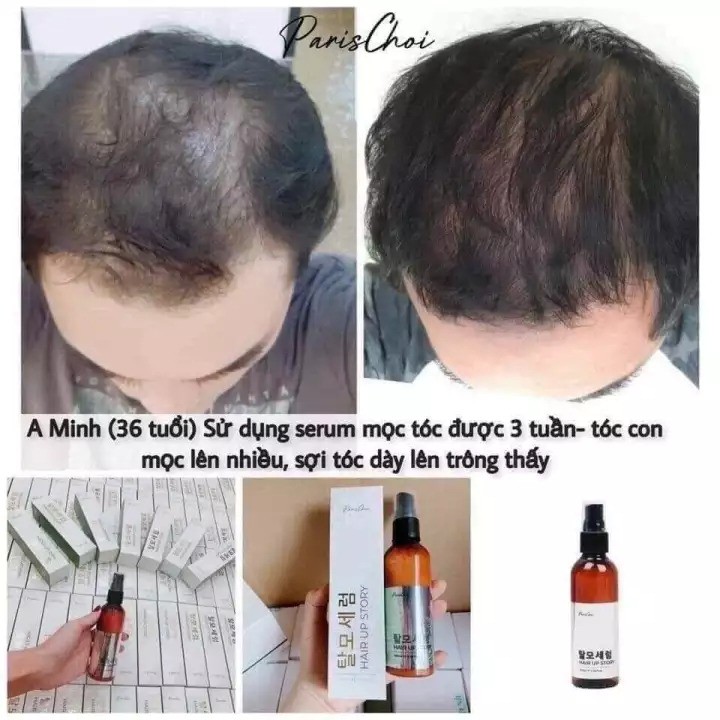 Xịt Mọc Tóc Hair Up Story Genie Hàn Quốc Kích Dưỡng Tinh Chất Mọc Tóc Nhanh Dài Chống Rụng Tóc 100ml - Minh An Beauty