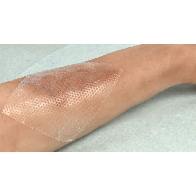 Tấm lưới silicone bảo vệ vết thương Mepitel One