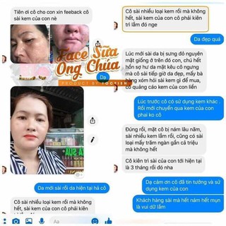 KEM FACE SỮA ONG CHÚA- S.O.N GROUP