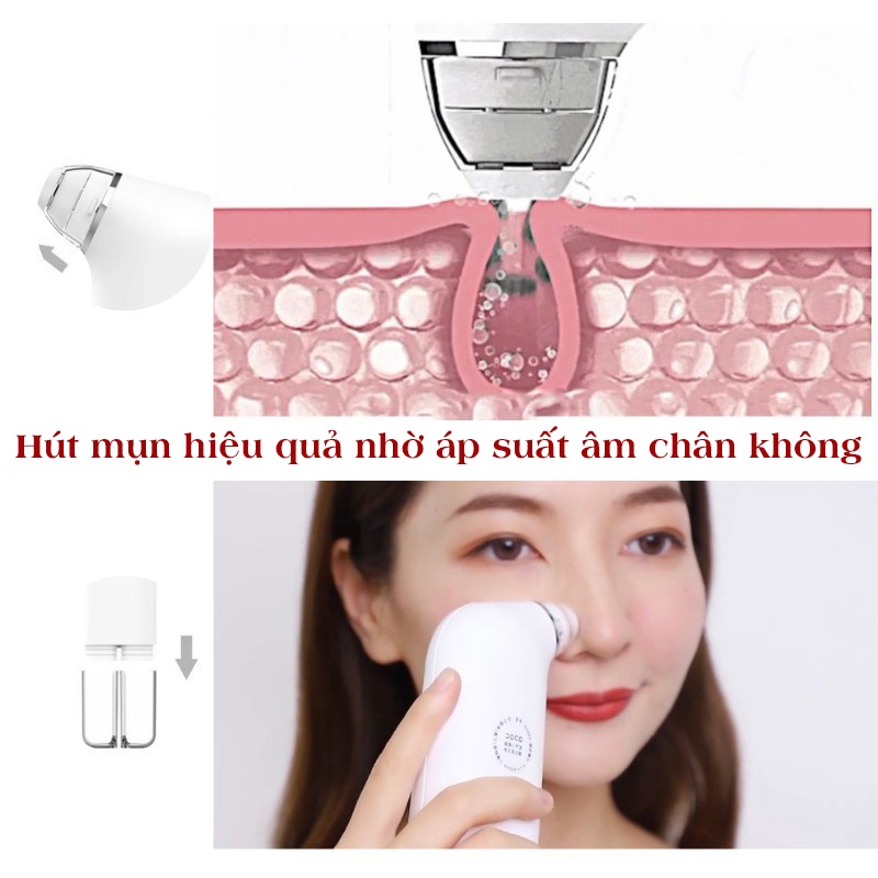 Máy Hút Mụn Xiaomi DOCO Đa Năng Thế Hệ Mới - Hút Mụn Đầu Đen, Mụn Cám, Rửa Mặt SunQueen-Bảo Hành 12 Tháng