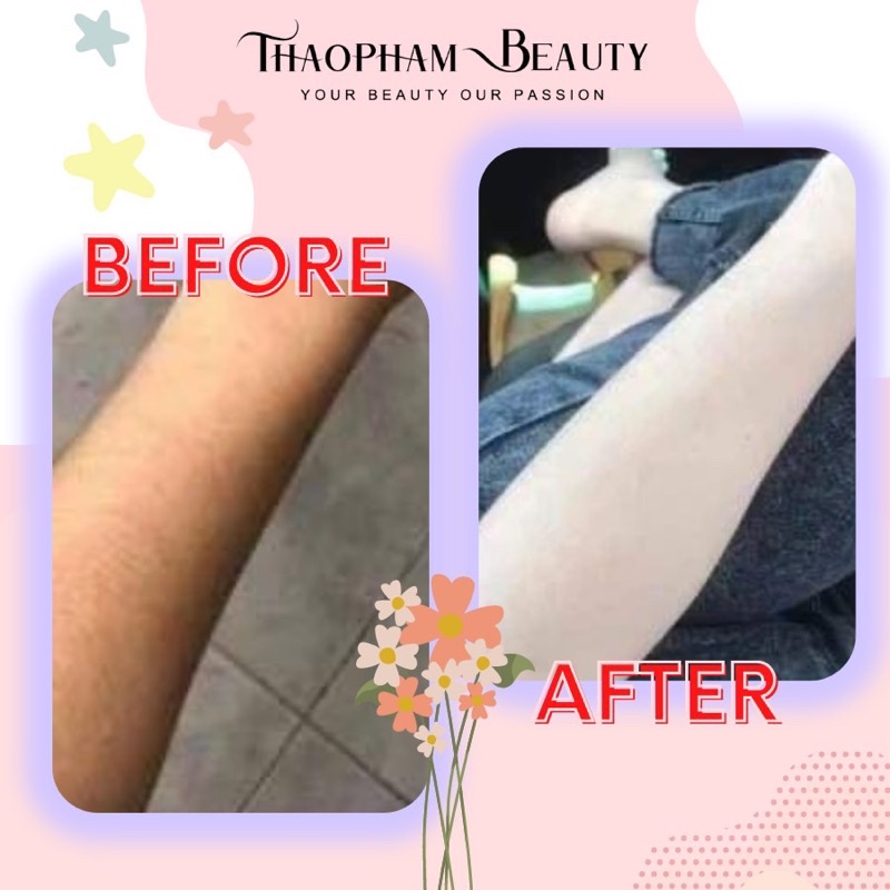 |GÓI SIÊU TIẾT KIỆM| COMBO SIÊU KÍCH TRẮNG MỜ THÂM CAO CẤP