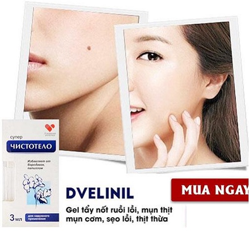 [CHÍNH HÃNG] Gel tẩy nốt ruồi, mụn cóc, mụn thịt, tàn nhang, sẹo lồi Develinil của Nga 3ml