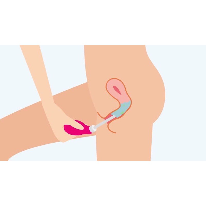 Allbyvy | DUNG DỊCH RỬA SUMMER' EVE DOUCHE