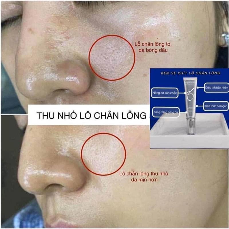 Tinh chất se khít lỗ chân lông Serum Instant Pore Refiner ZO