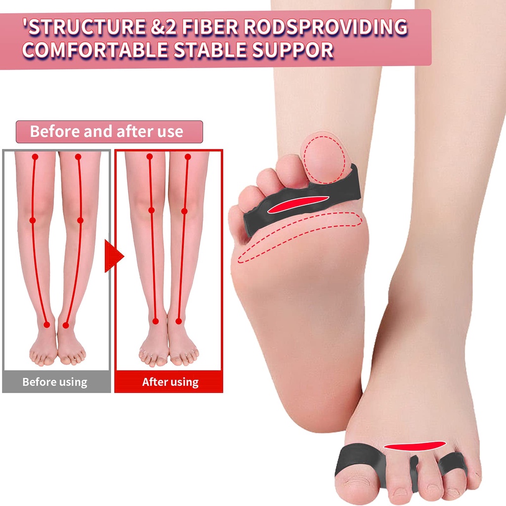 Cặp đệm tách/ chăm sóc làm thẳng ngón chân cái JUNLAIKANG