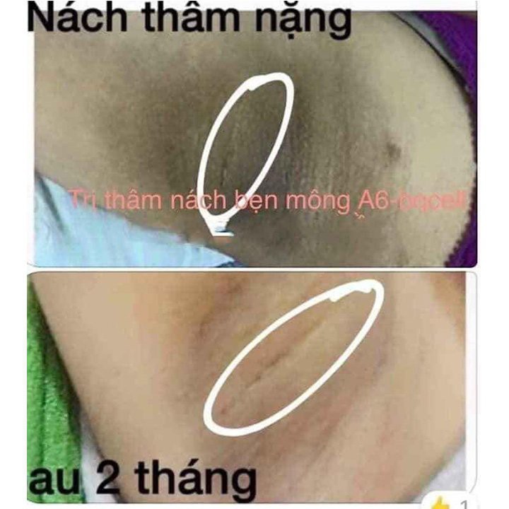 lô hàng nhanh (CHÍNH HÃNG)💝FREESHIP💝 KEM  LÀM TRẮNG NÁCH BẸN MÔNG GCELL HÀN QUỐC | BigBuy360 - bigbuy360.vn