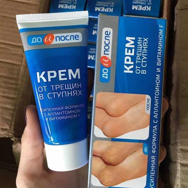 hộp kem nứt gót chân Kpem Foot Cream giảm nẻ chân nứt chân khô da chân dưỡng gót chân tặng kèm máy massa mặt