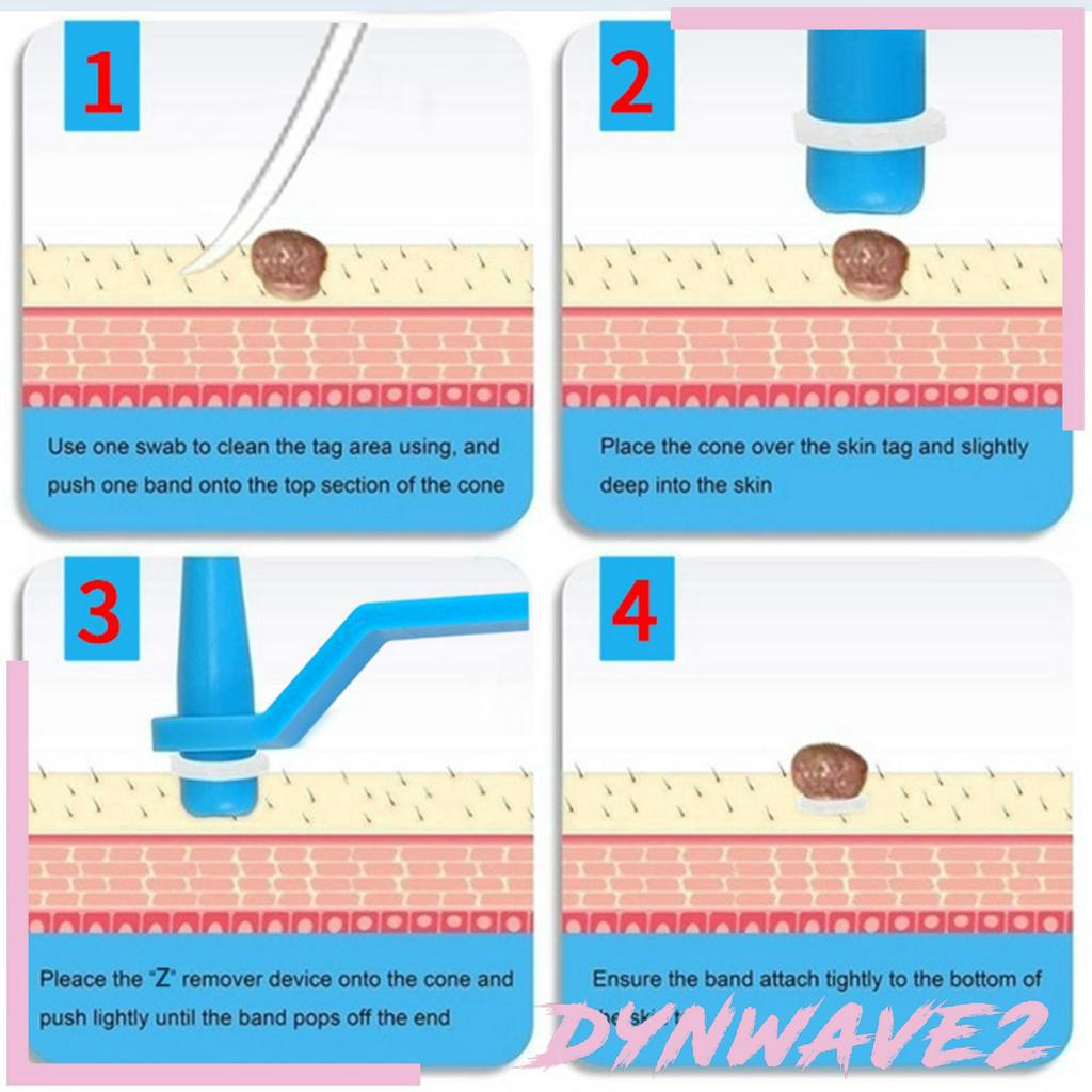 Bộ Dụng Cụ Loại Bỏ Đốm Đen Trên Da Dynwave2